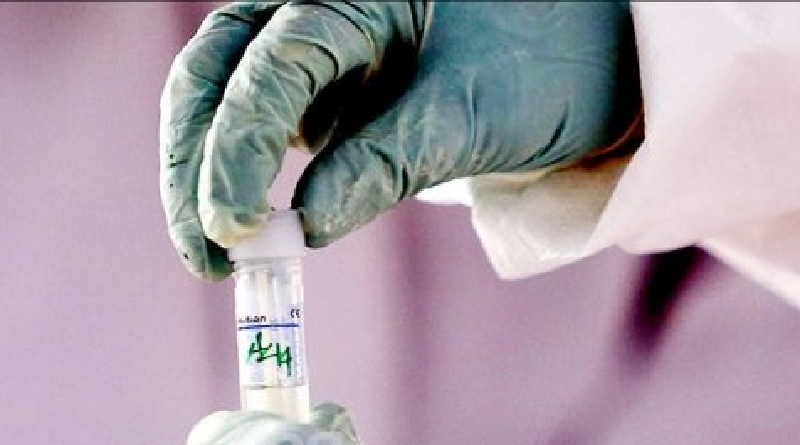 98 Pasien Negatif, Klaster Covid-19 Secapa TNI AD Jalani Swab Test Kedua