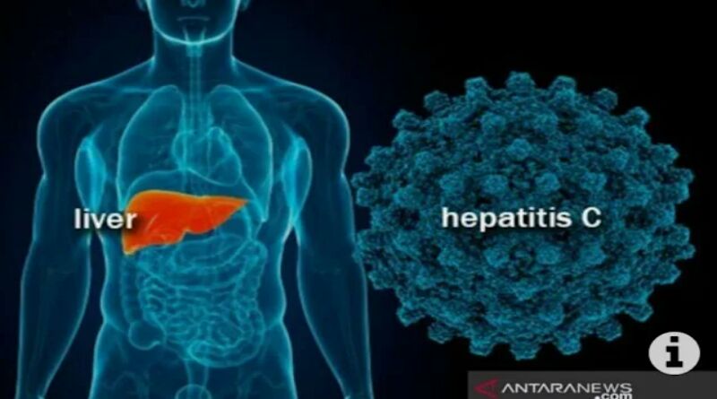 Indonesia Tingkatkan Kewaspadaan Hepatitis Akut Misterius pada Anak